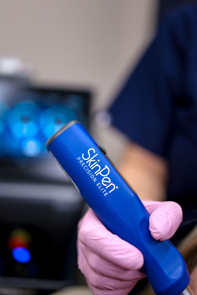 Skinpen Microneedling