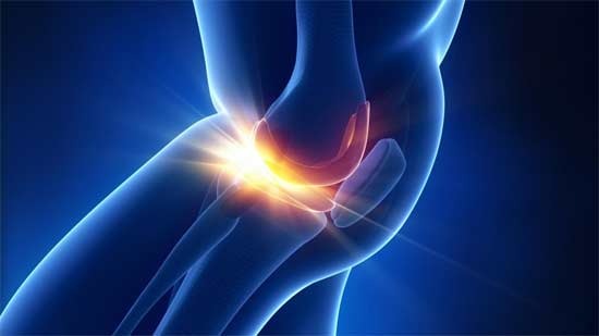 Degenerated Joints