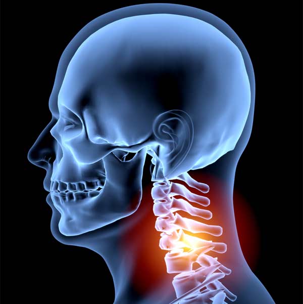 Neck Pain1