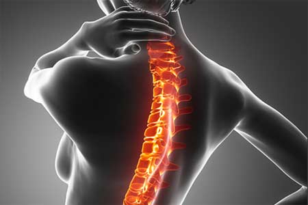 Scoliosis2