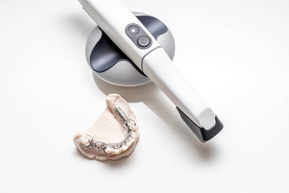 Technology- Trios scanner