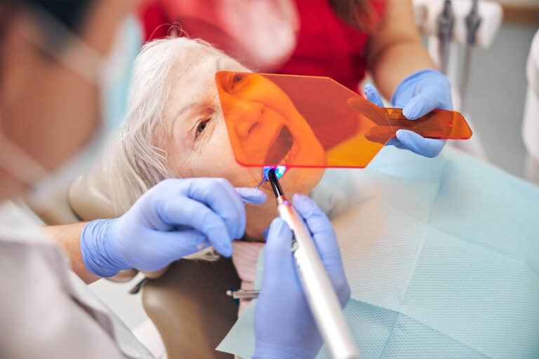 Composite Bonding