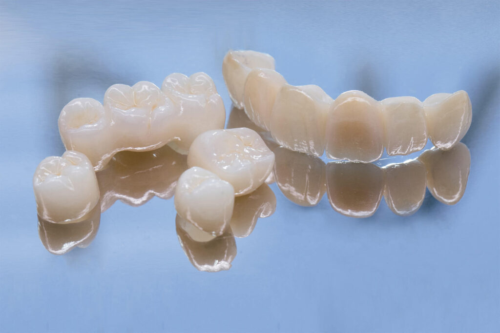 Composite Restorations
