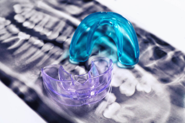 Mouth Guards