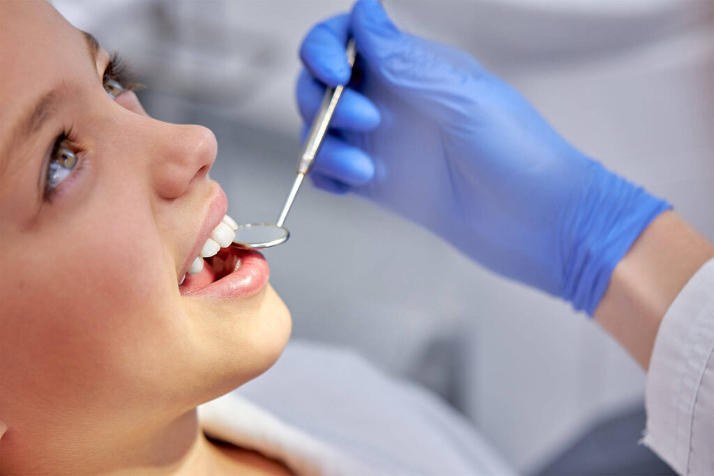 Dental Sealants