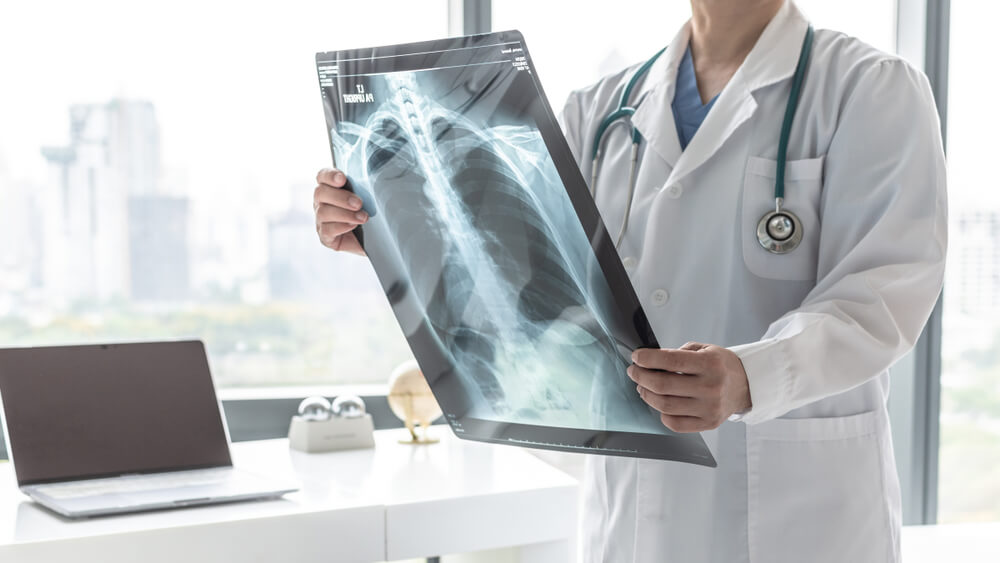 Doctor with radiological chest x-ray film for medical diagnosis on patient’s health on COVID-19, asthma, lung disease and bone cancer illness