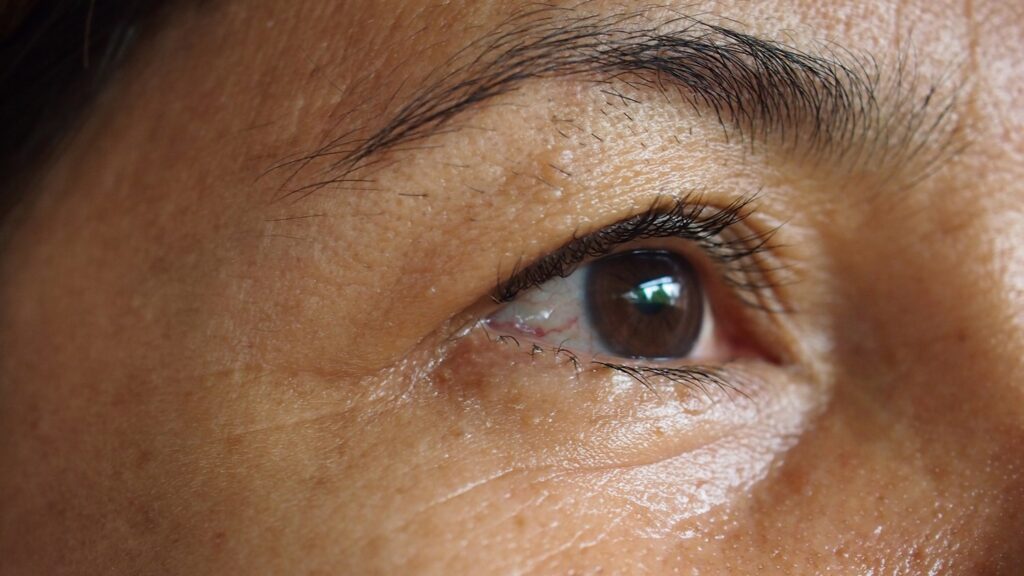 Close Upskin Face Problem Asian Woman