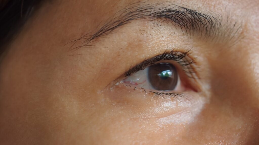 Close Upskin Face Problem Asian Woman