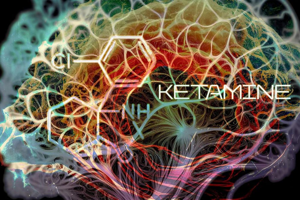 neuro image