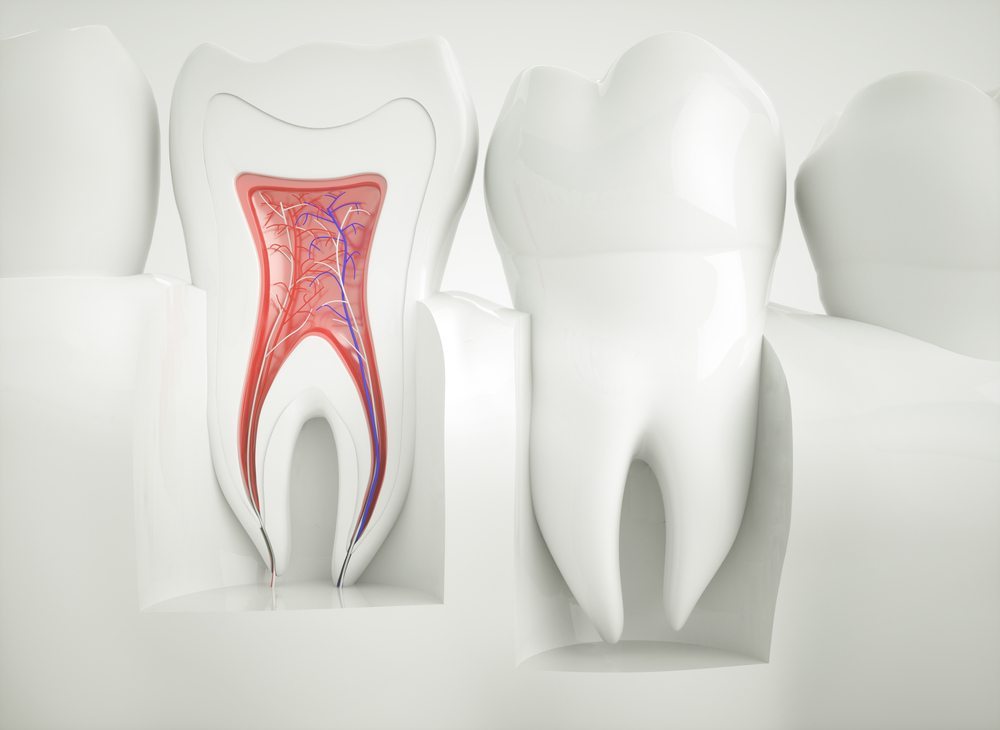 root-canal