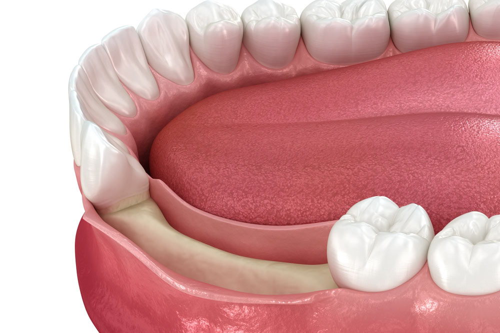 Bone_Grafting