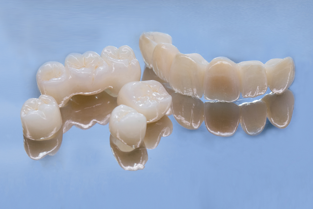 https://www.shutterstock.com/catalog/licenses?q=1869834385#:~:text=Metal%20Free%20Ceramic%20Dental%20Crowns.%20Ceramic%20zirconium%20in%20final%20version