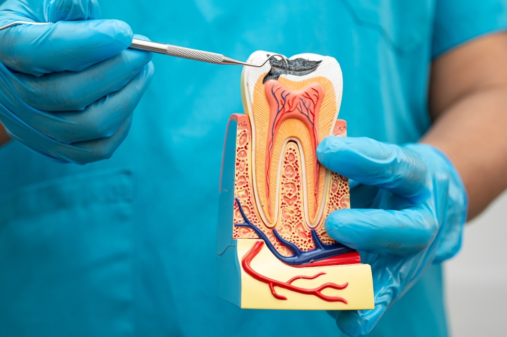 Asian dentist holding dental implant, artificial tooth roots into jaw, root canal of dental treatment