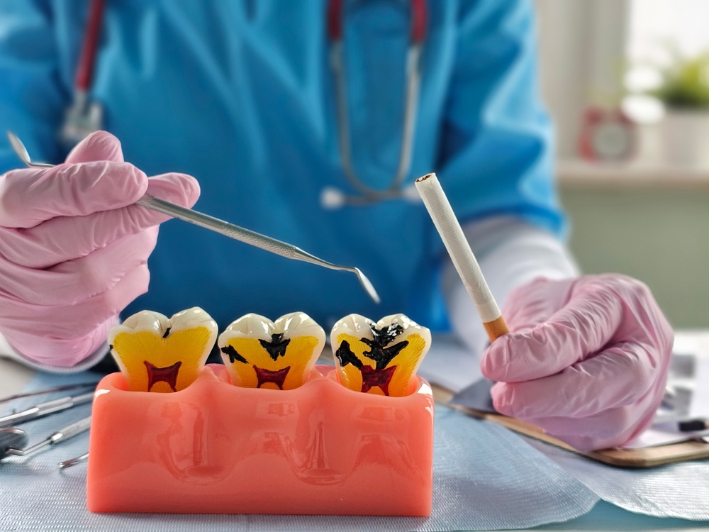 Dental education on the impact of smoking on oral health with models and tools in a clinic setting