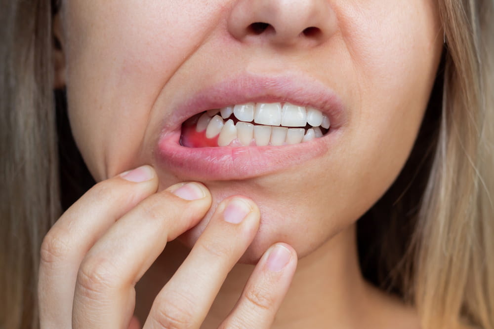 Gum inflammation. Close-up of a young woman showing bleeding gums