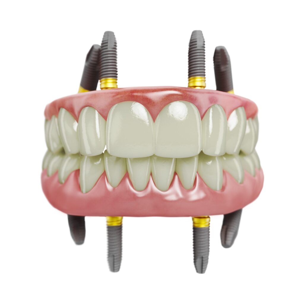 Ultra All-on-4™ Implants