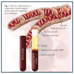 image illustrates the components of blood and how they separate after being spun in a centrifuge