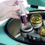 Arthrex ACP Double-Syringe System being used with a centrifuge, likely for preparing autologous conditioned plasma (ACP) or platelet-rich plasma (PRP).