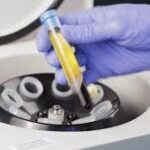 Centrifuge PRP