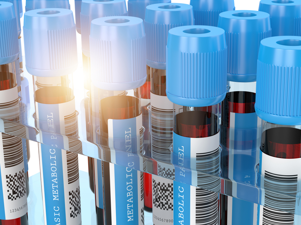 blood samples in vacutainer tubes, labeled for a Basic Metabolic Panel (BMP).