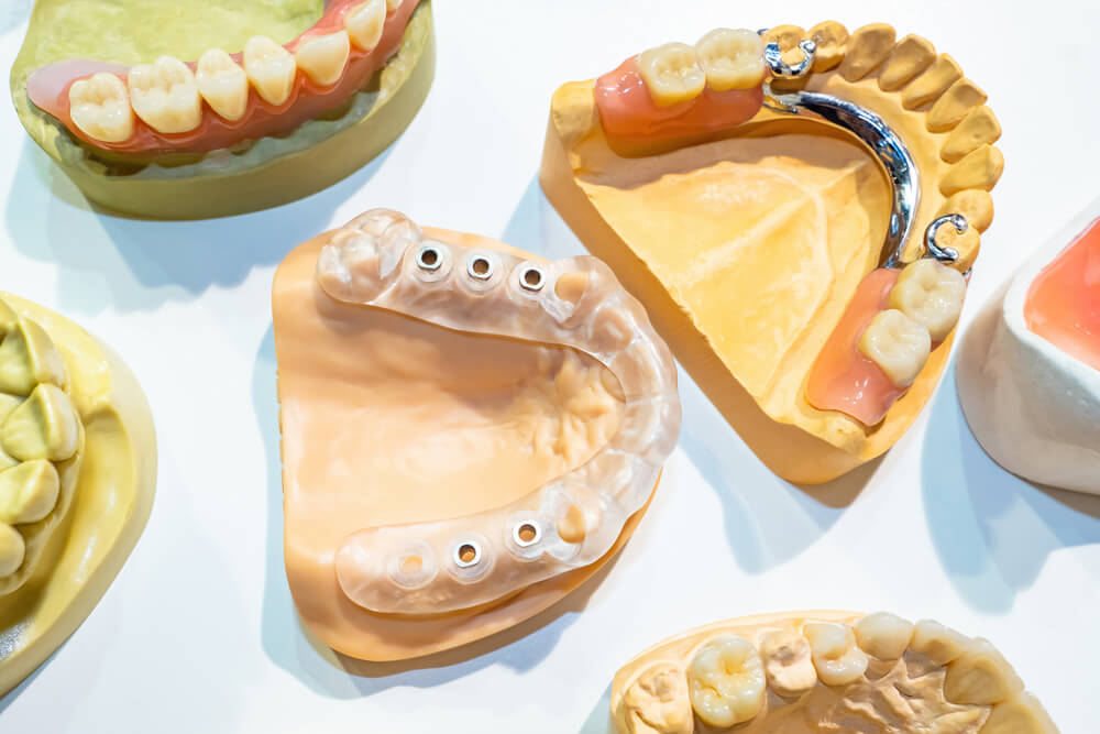 Prosthetic human jaws