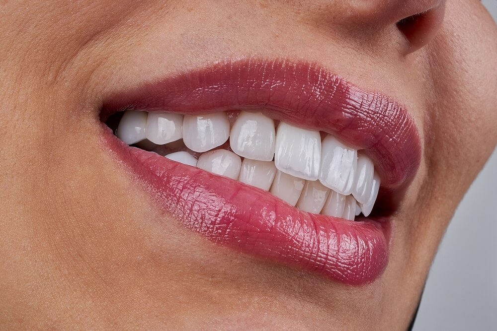 Cosmetic dentistry enhances the appearance of teeth