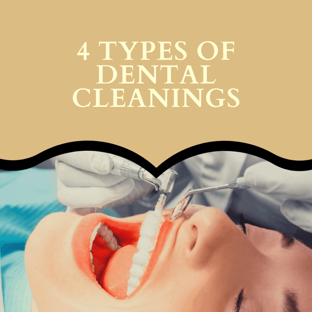 4 types of dental cleanings-min
