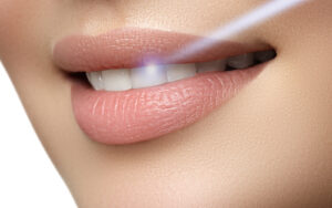 Dental Restoration