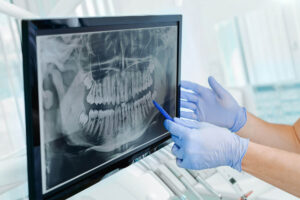 Digital Dentistry Digital Scanning
