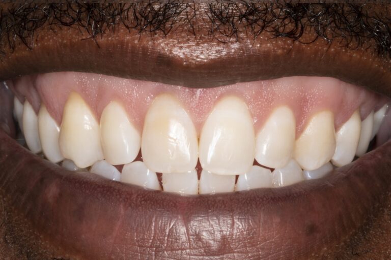 Guy1smile-after-scaled