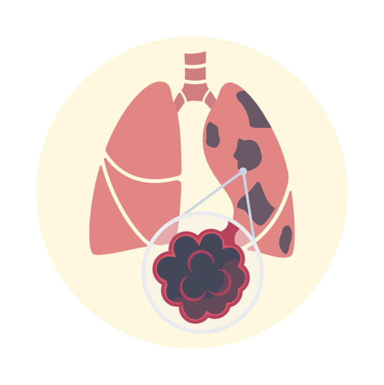 illustration - chronic respiratory conditions