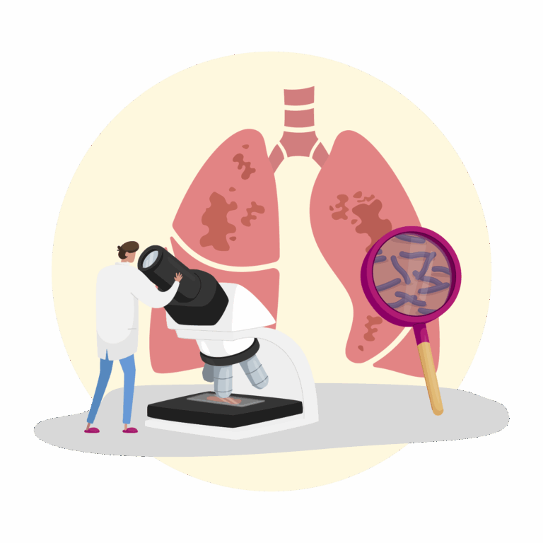 illustration - lung nodule evaluation
