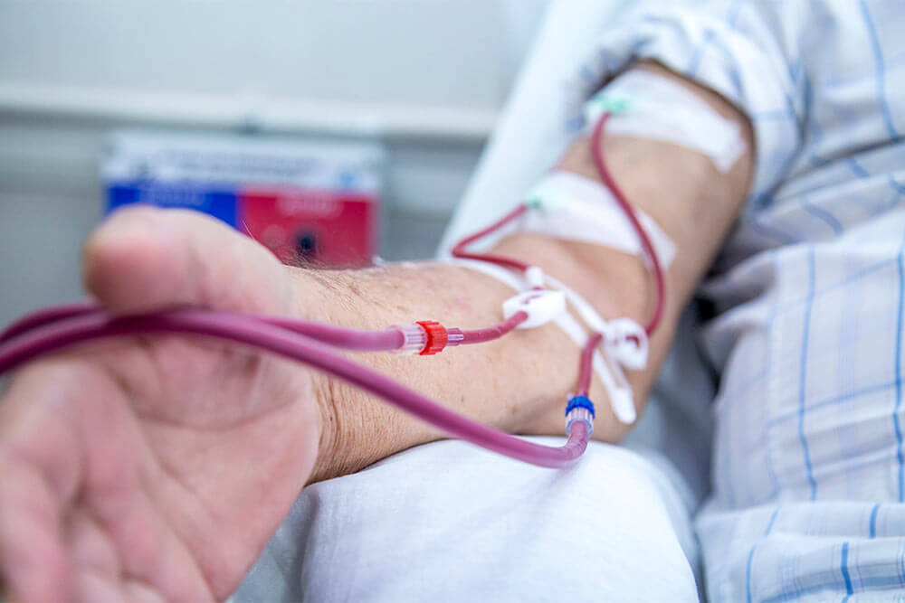 Dialysis Access