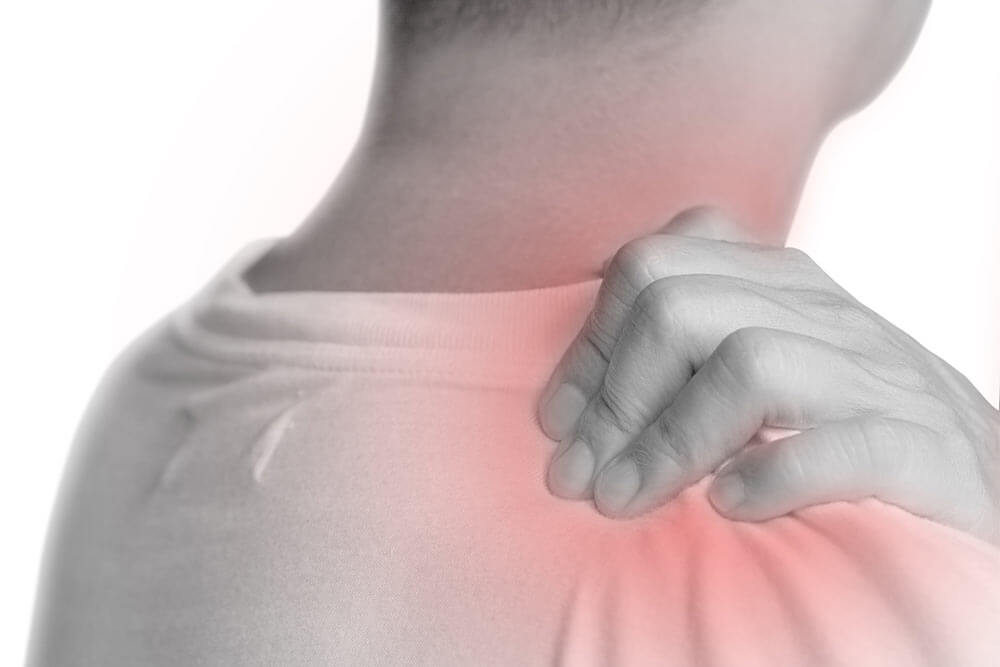 Thoracic Outlet Syndrome