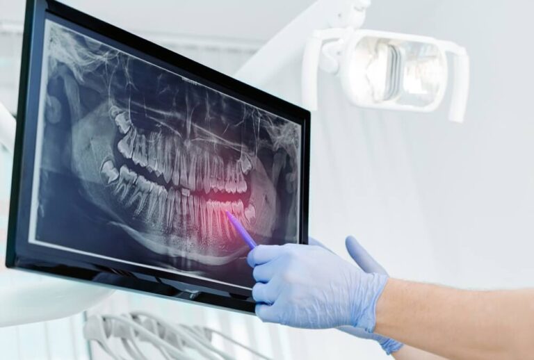 Hands doctor dentist in gloves show the teeth on x-ray on digital screen in dental clinic