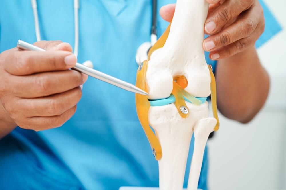 Knee osteoarthritis, Doctor showing model knee joint orthopedic