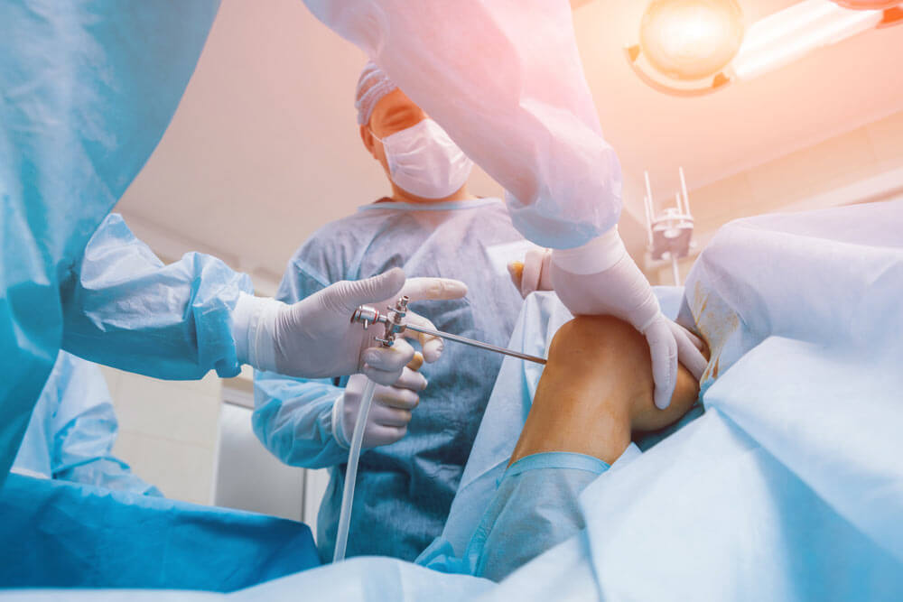Arthroscope surgery. Orthopedic surgeons in teamwork in the operating room with modern arthroscopic tools