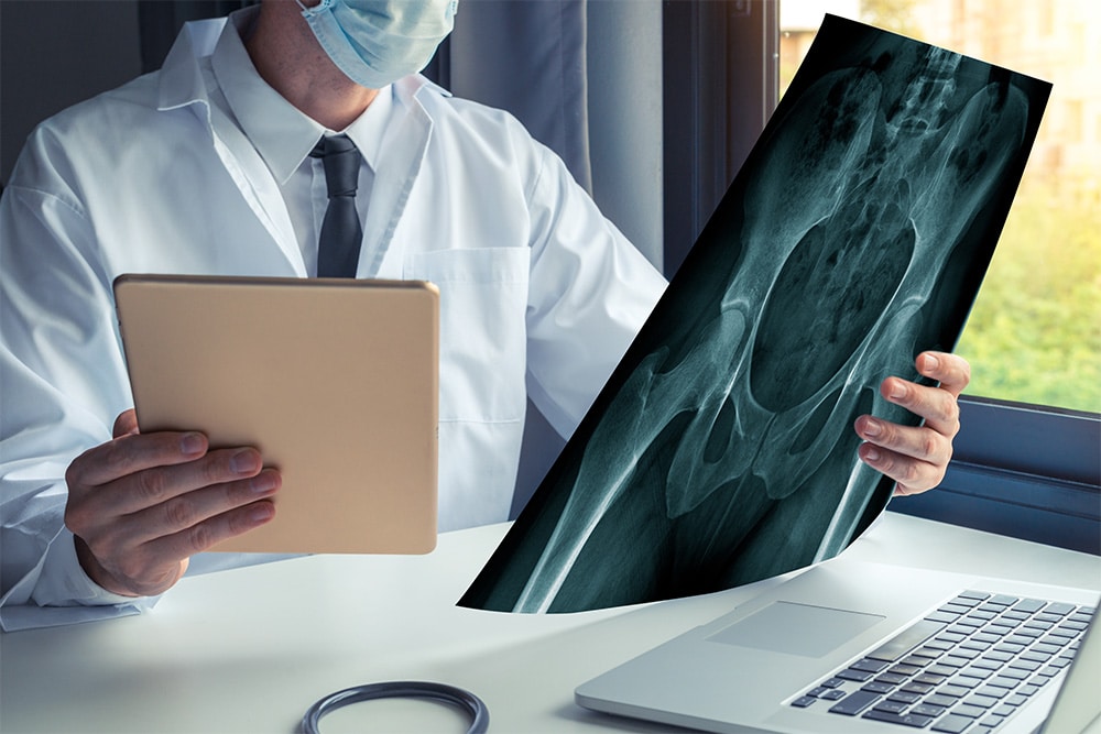How to Find a Tampa Hip Surgeon