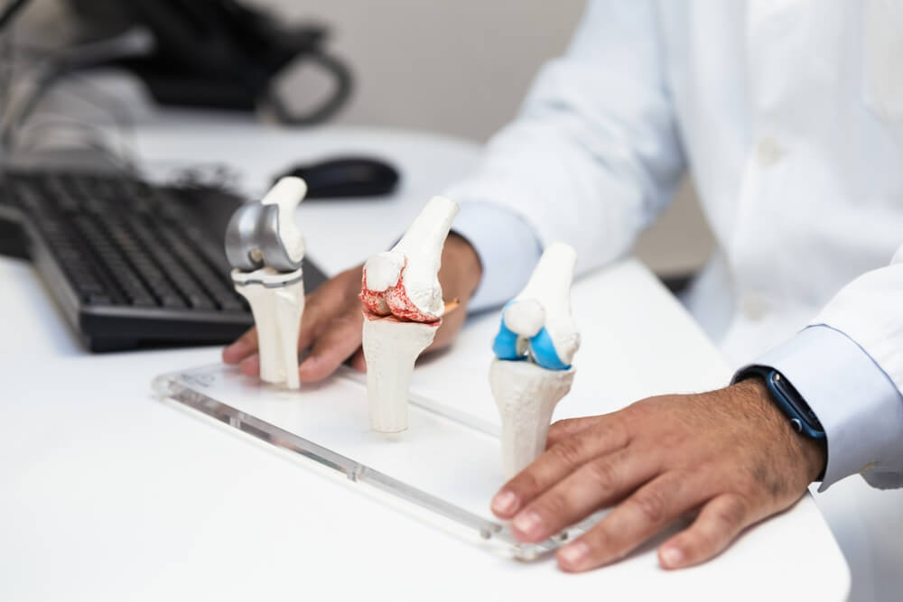 Orthopedic doctor explaining knee implants to a patient in his office.