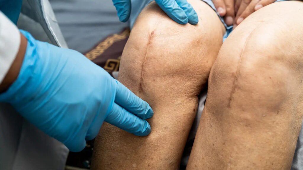 PRP vs. Traditional Treatments