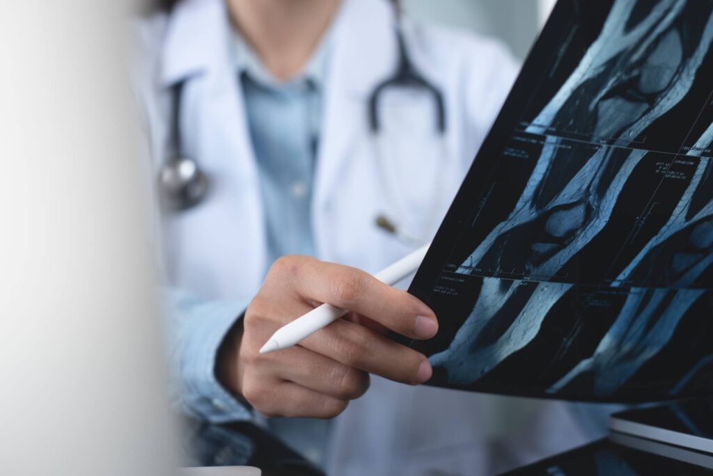 Orthopedics surgeon doctor examining patient's knee joint x-ray films, MRI bone
