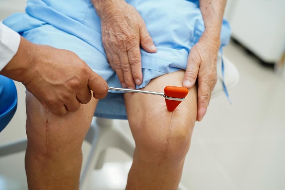 Clearwater and Palm Harbor, Florida Total Knee Replacement