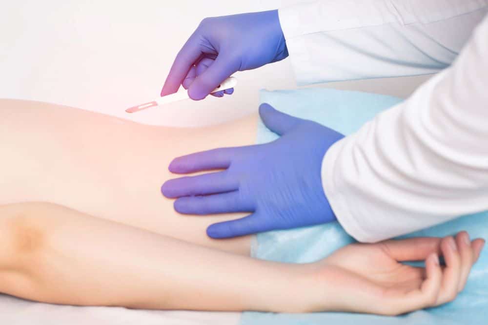 What Is Kyphoplasty Surgery
