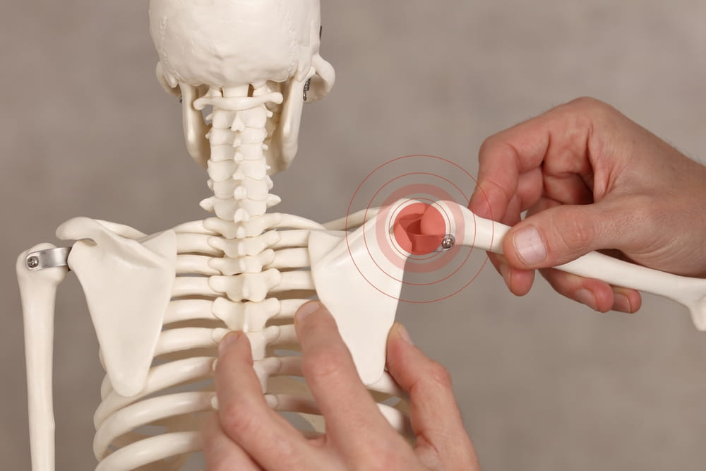 Shoulder joint pain. Physiotherapy , Surgery Recovery concept.