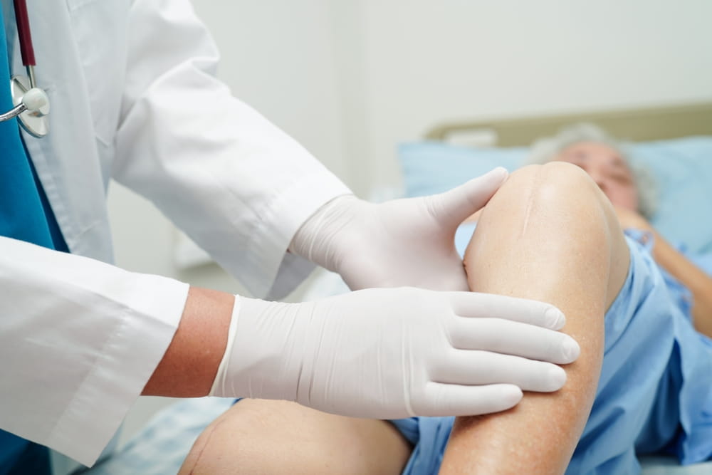 Doctor checking Asian elderly woman patient with scar knee replacement surgery in hospital.