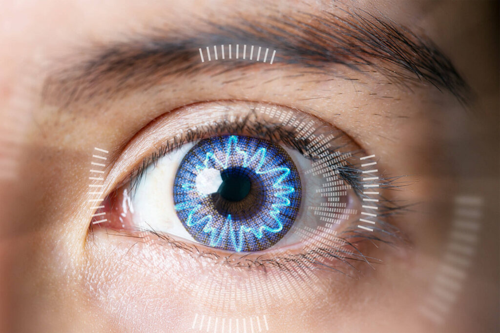 LASIK