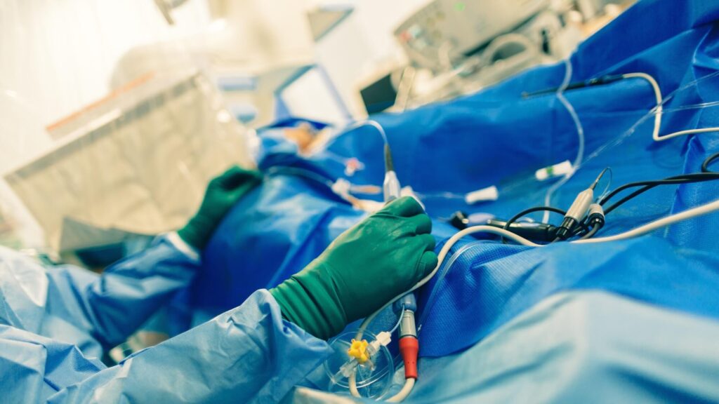 ablation tools to improve atrial fibrillation with radiofrequency energy catheters