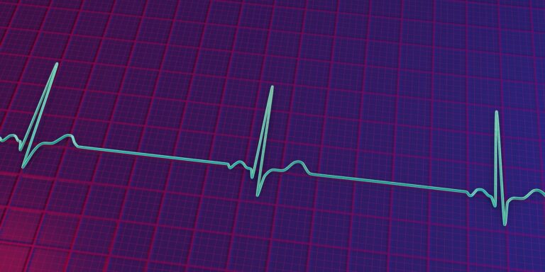 A detailed 3D illustration of an electrocardiogram displaying sinus bradycardia
