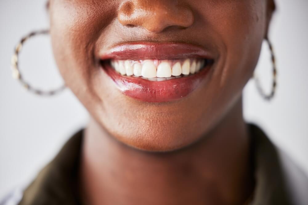 female person with clean white teeth