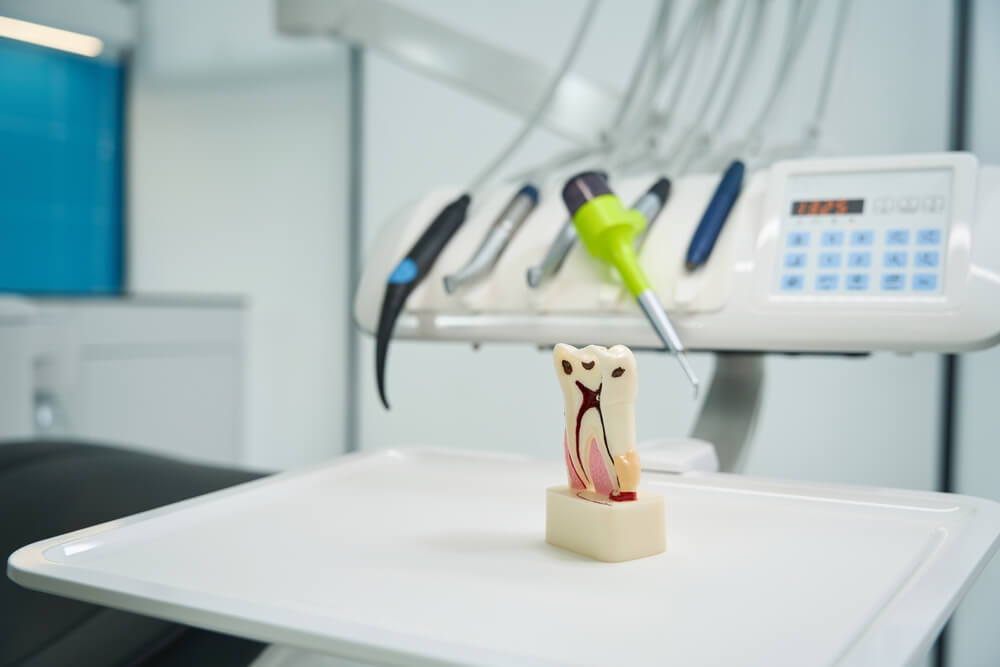 tooth model with root canals and caries